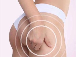 Как победить целлюлит, подскажут народные рецепты