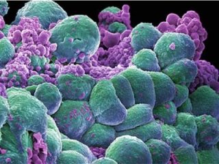 Против дрожжевого грибка есть эффективные народные средства