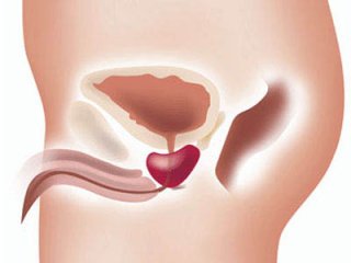 Народные средства от простатита