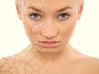 Народные средства против сухой экземы