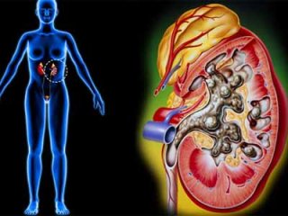 Травяные сборы устраняют в почках засоры