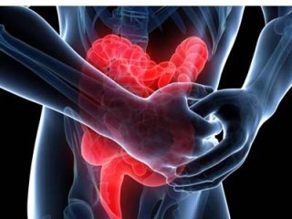 Эффективные рецепты народной медицины для лечения колита