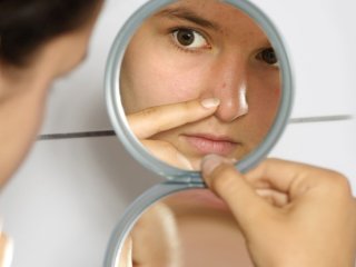 Почему появляются прыщи и как с ними бороться?