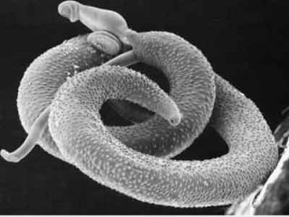 Лечение аскаридоза народными средствами