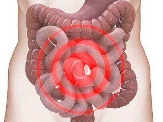 Раздраженными могут не только нервы, но и кишечник