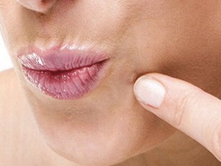 Бабушкины рецепты борьбы с папилломами