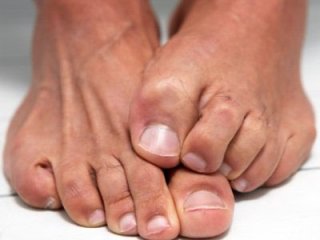 Проблемы с ногтями решают народные средства