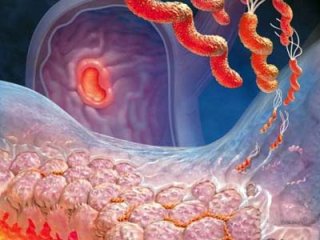 Воспаление желудка? Лечим средствами народной медицины