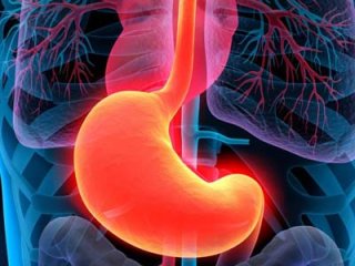 Проверенные народные средства для лечения эрозии желудка