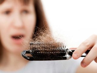 Выпадение волос: причины и лечение
